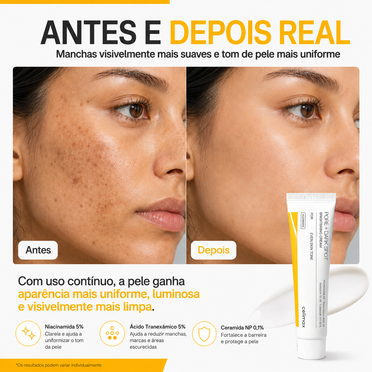 Creme Facial Clareador Celimax Ácido Tranexâmico 5% + Niacinamida 5% 35ml