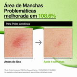 Sérum Ácido Hialurônico Anua Azelaico 10 | Pele Sensivel