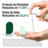 Óleo de Limpeza Facial Anua Heartleaf | Controle de Oleosidade
