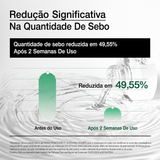 Tônico Facial Ácido Hialurônico Anua Heartleaf 77 Calmante