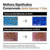 Esfoliante Facial em Pó Anua | Enzimas de Arroz + Ceramida