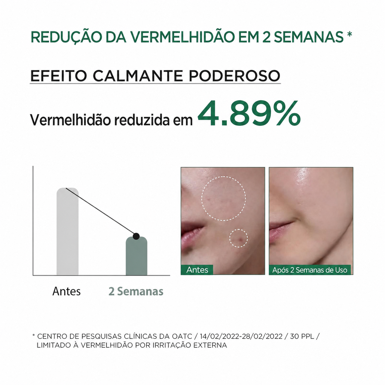 Sérum Calmante Anua Heartleaf 80% | Pele Sensível
