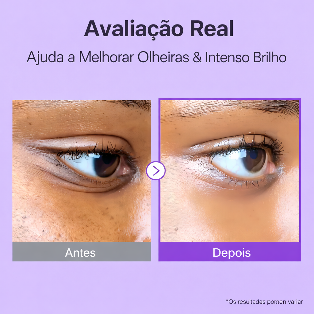 Numbuzin No.9 NAD+ Retinol Eye Cream — Creme para Olhos