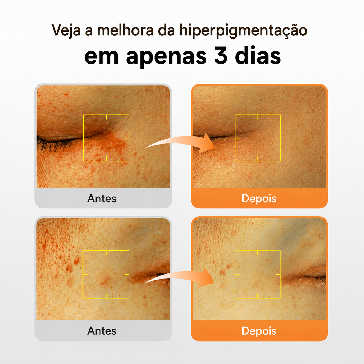 KIT ABIB — Manchas + Proteção Solar