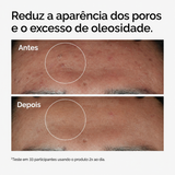 Sérum Niacinamida 10% + Zinco 1% The Ordinary | Poros e Oleosidade