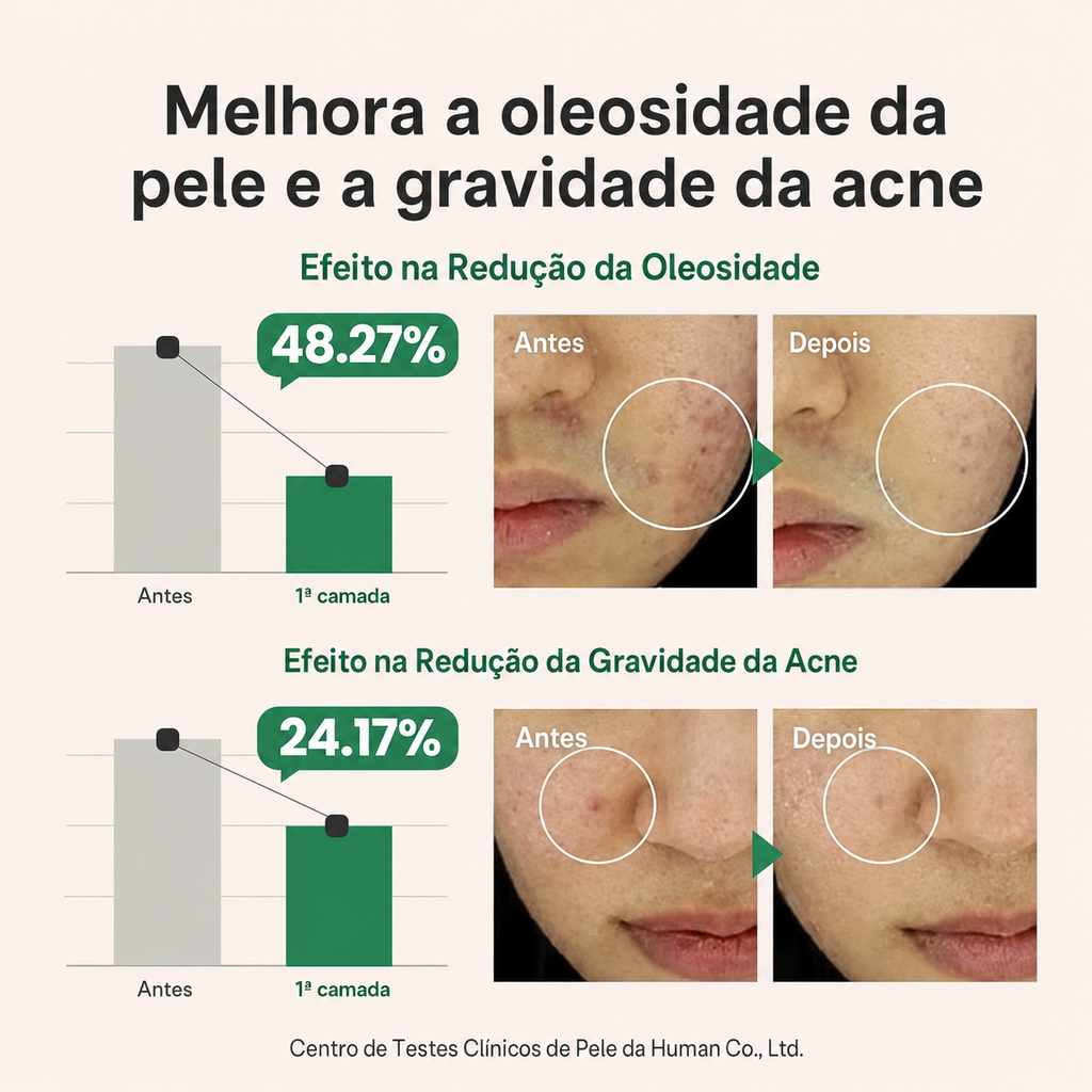 Sérum Secativo de Espinhas e Acne AXIS-Y | Melaleuca + Niacinamida 2%