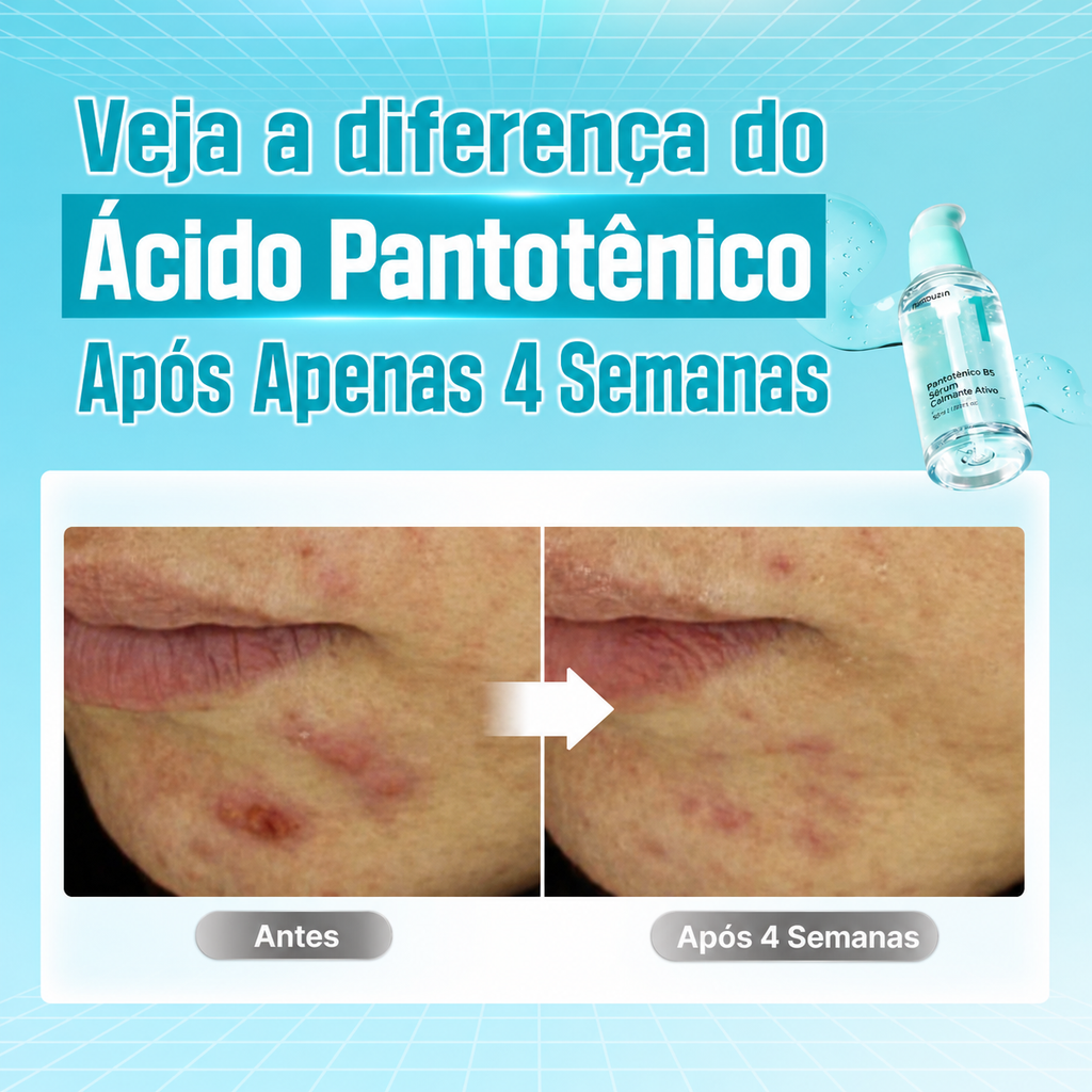 Numbuzin No.1 Pantothenic B5 Soothing Serum | Compre Ja

