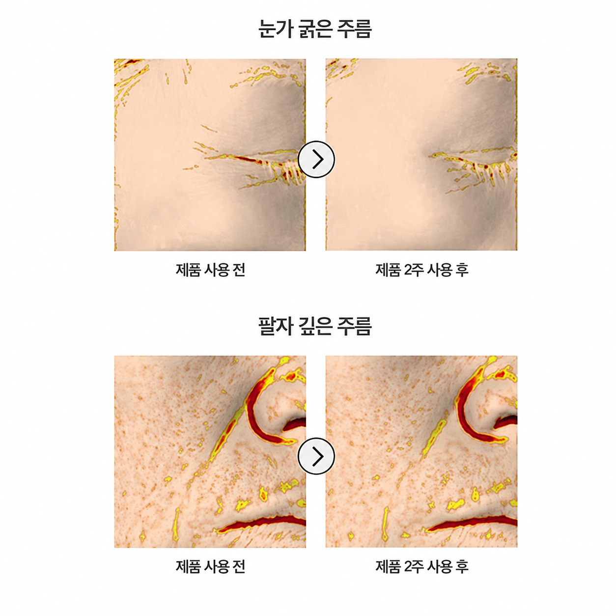 VT Cosmetics pdrn reedle shot