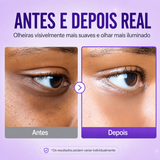 Creme Para Olheiras com Retinol e Niacinamida 4% Numbuzin | NAD+ Peptídeos